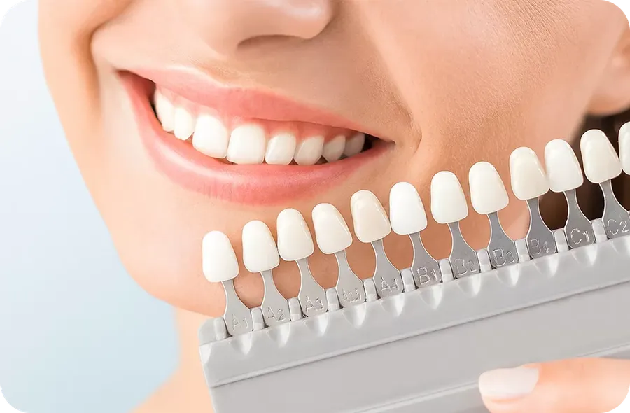 ホワイトニング